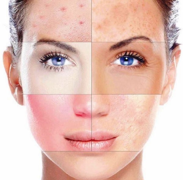 Визначаємо тип шкіри обличчя в домашніх умовах